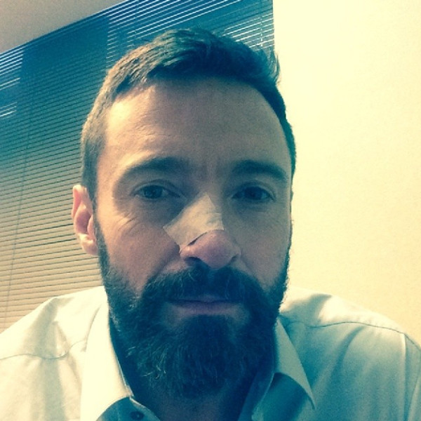 hugh-jackman-skin-cancer